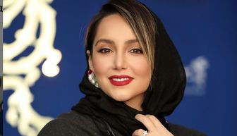 نازنین بیاتی چهره اش را دگرگون کرد نازنین بیاتی چهره اش را دگرگون کرد