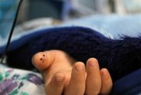 قصور پزشکی دختر ۱۰ ساله را به کما برد و جان پدر را گرفت