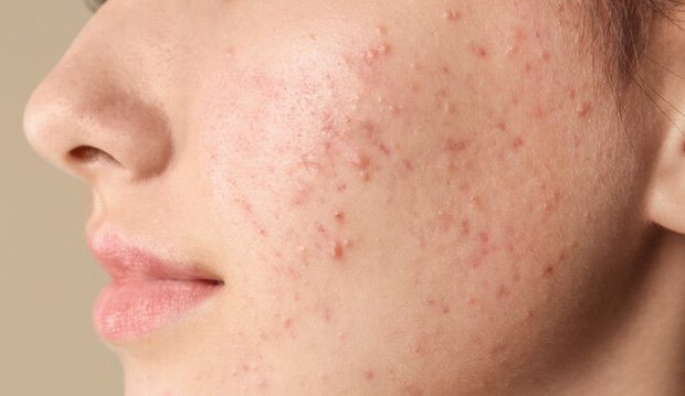 نوشیدن این مایعات پوستتان را شفاف میکند نوشیدن این مایعات پوستتان را شفاف میکند